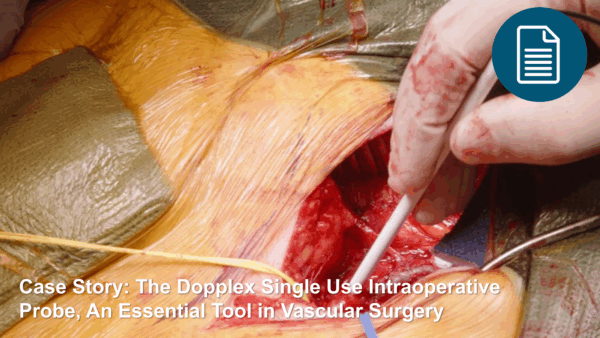 Dopplex® Single Use Intraoperative Doppler Probe - Huntleigh Healthcare
